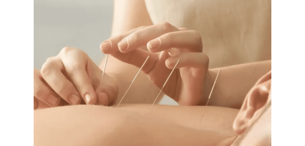 How to Setup an Acupuncture Insurance Billing?