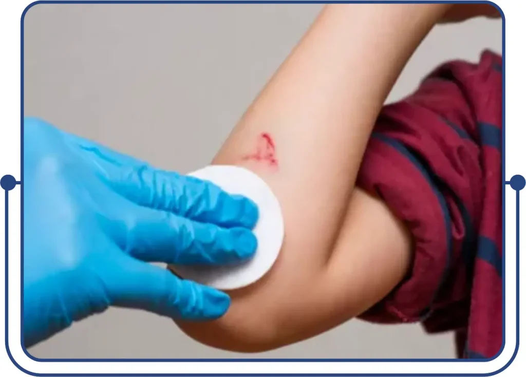 Specialities Wound Care Billing Services