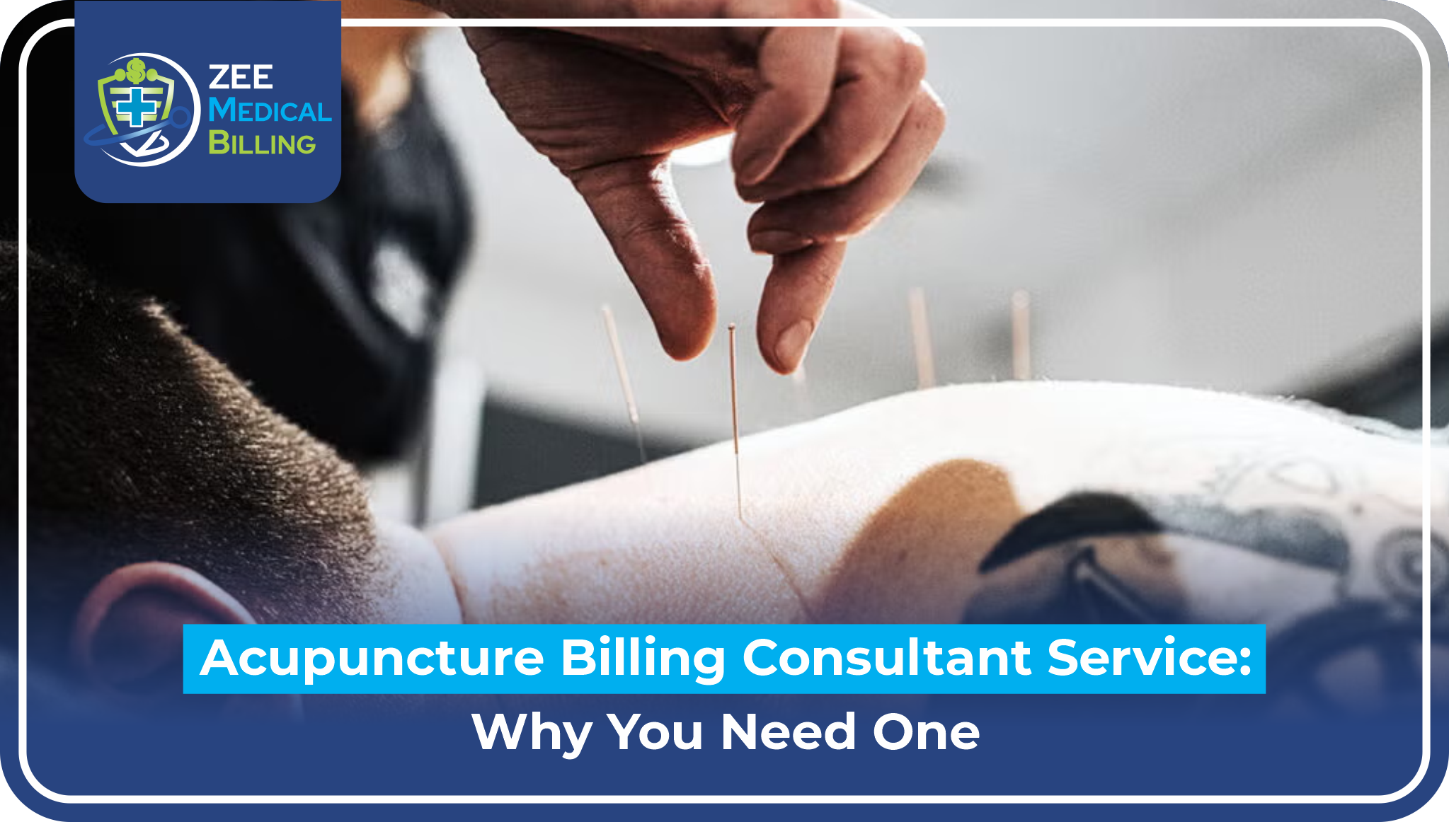 Acupuncture billing consultant service - practitioner placing acupuncture needles on patient's back demonstrating professional treatment requiring specialized billing expertise